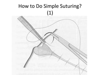 Basic Suturing Manual.ppt
