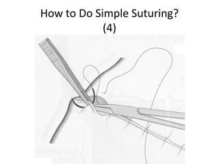 Basic Suturing Manual.ppt