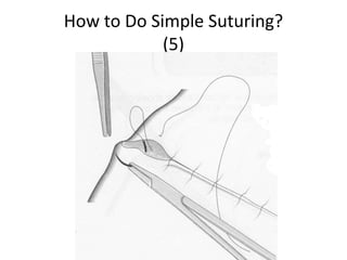 Basic Suturing Manual.ppt