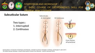 Subcuticular Stitch R BASIC SUTURING TECHNIQUE.................. | PPTX