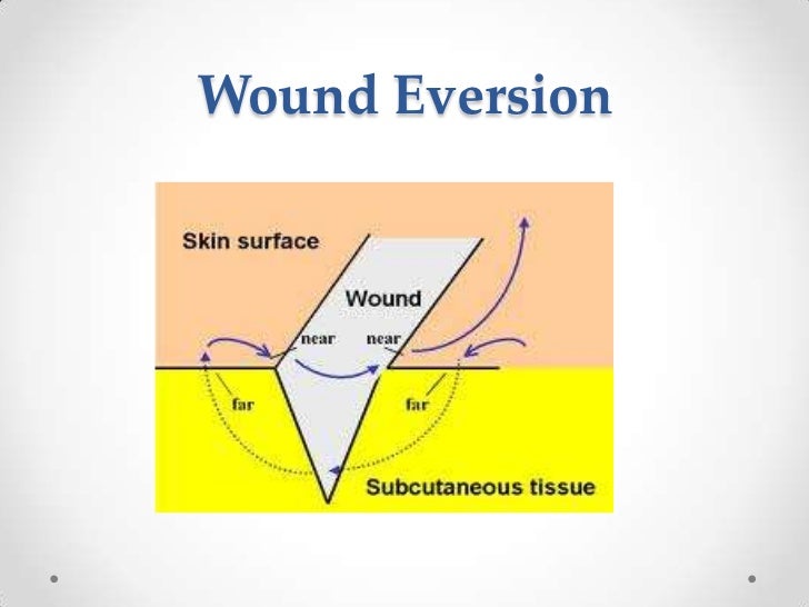 Basic suturing
