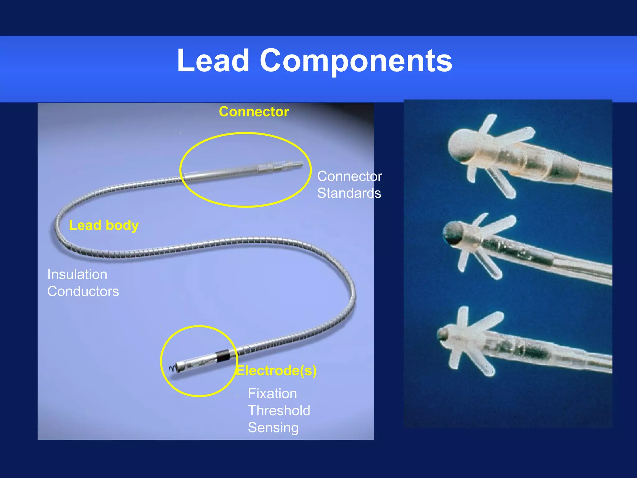 Lead Components
Connector
Lead body
Electrode(s)
Insulation
Conductors
Fixation
Threshold
Sensing
Connector
Standards
 