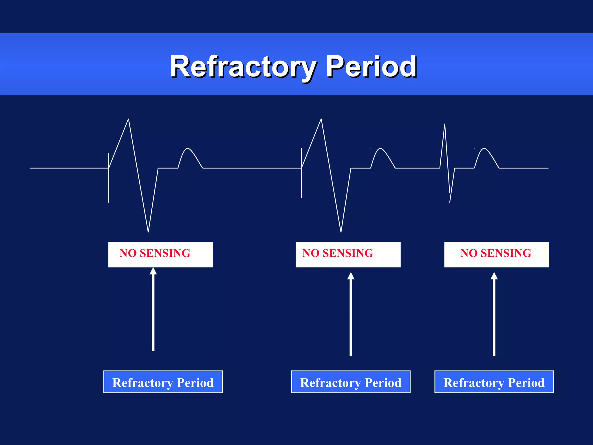 Refractory PeriodRefractory Period
Refractory Period Refractory Period Refractory Period
NO SENSING NO SENSING NO SENSING
 