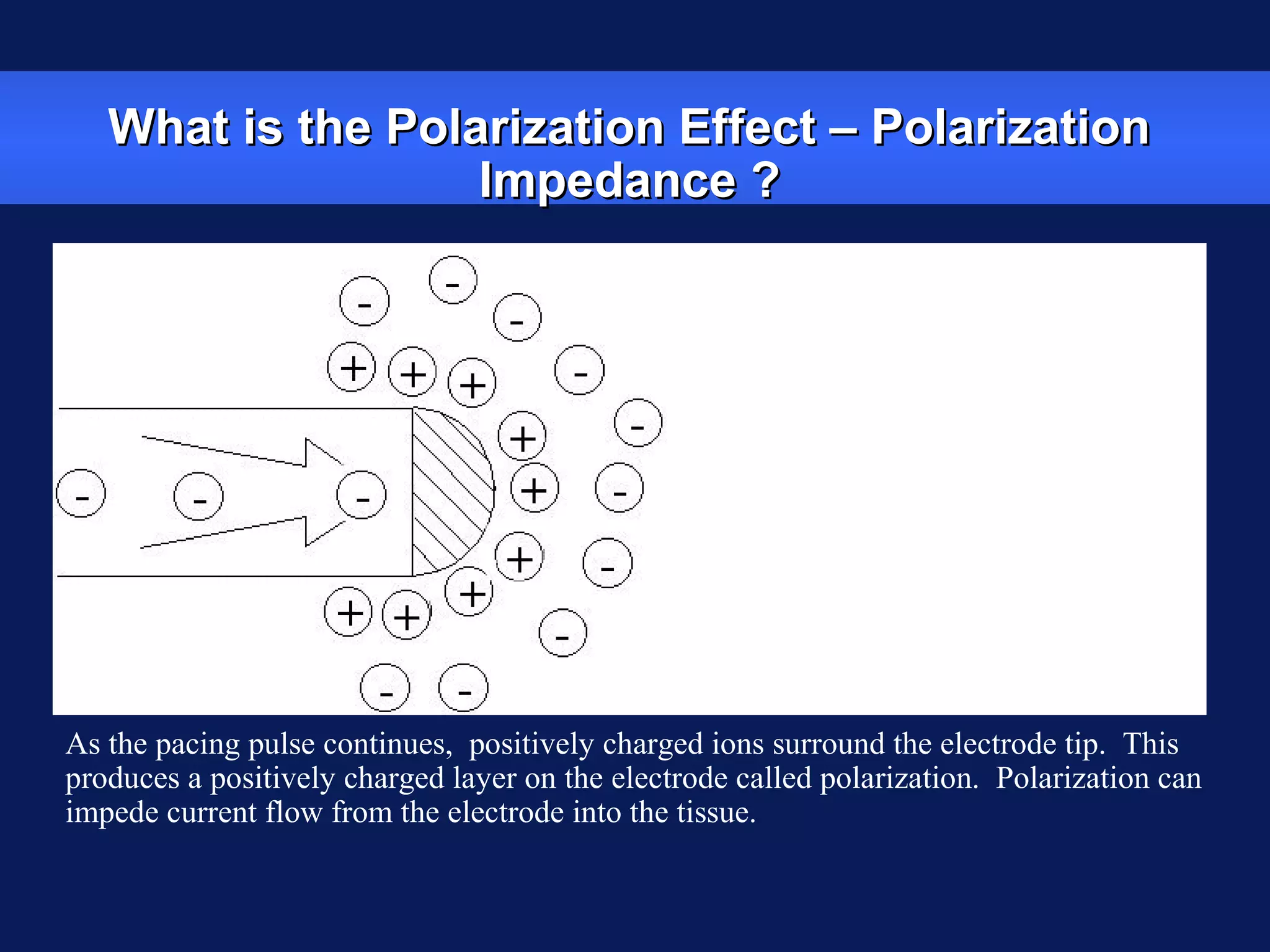 What is the Polarization Effect – PolarizationWhat is the Polarization Effect – Polarization
Impedance ?Impedance ?
As the pacing pulse begins, electrons from the pacemaker battery flow to the lead
tip and positively charged ions from the tissue are attracted to the lead tip.
Initially, the movement of these negatively
charged ions results in the flow of current
from the electrode into the myocardium.
As the pacing pulse continues, positively charged ions surround the electrode tip. This
produces a positively charged layer on the electrode called polarization. Polarization can
impede current flow from the electrode into the tissue.
 