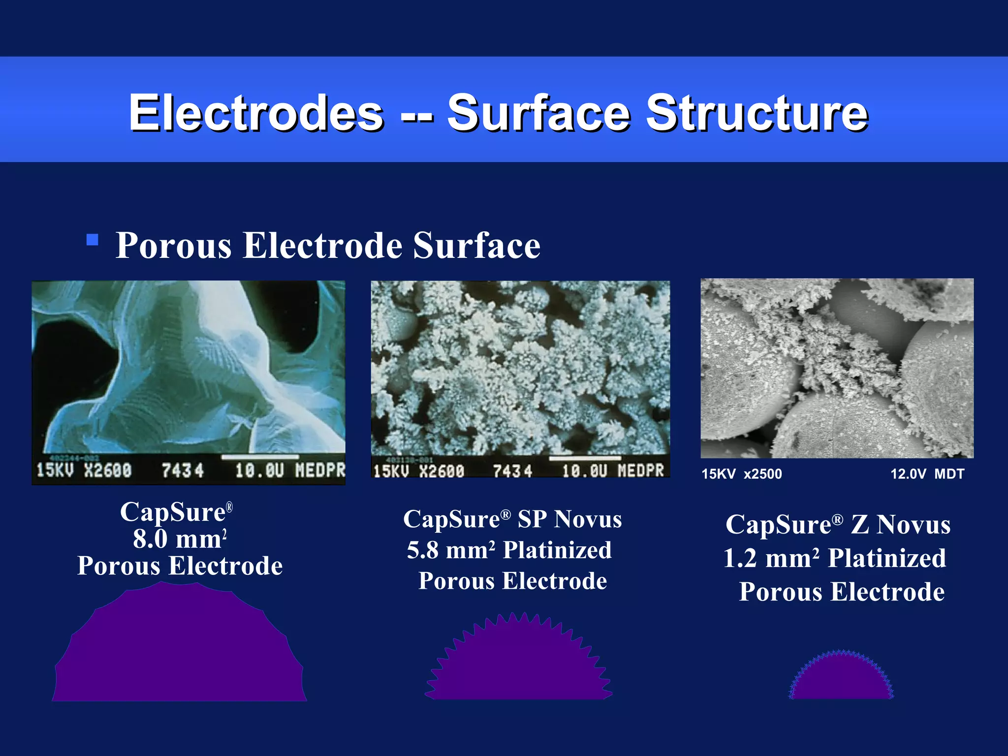 Electrodes -- Surface StructureElectrodes -- Surface Structure
 Porous Electrode Surface
CapSure®
8.0 mm2
Porous Electrode
CapSure®
SP Novus
5.8 mm2
Platinized
Porous Electrode
CapSure®
Z Novus
1.2 mm2
Platinized
Porous Electrode
15KV x2500 12.0V MDT
 