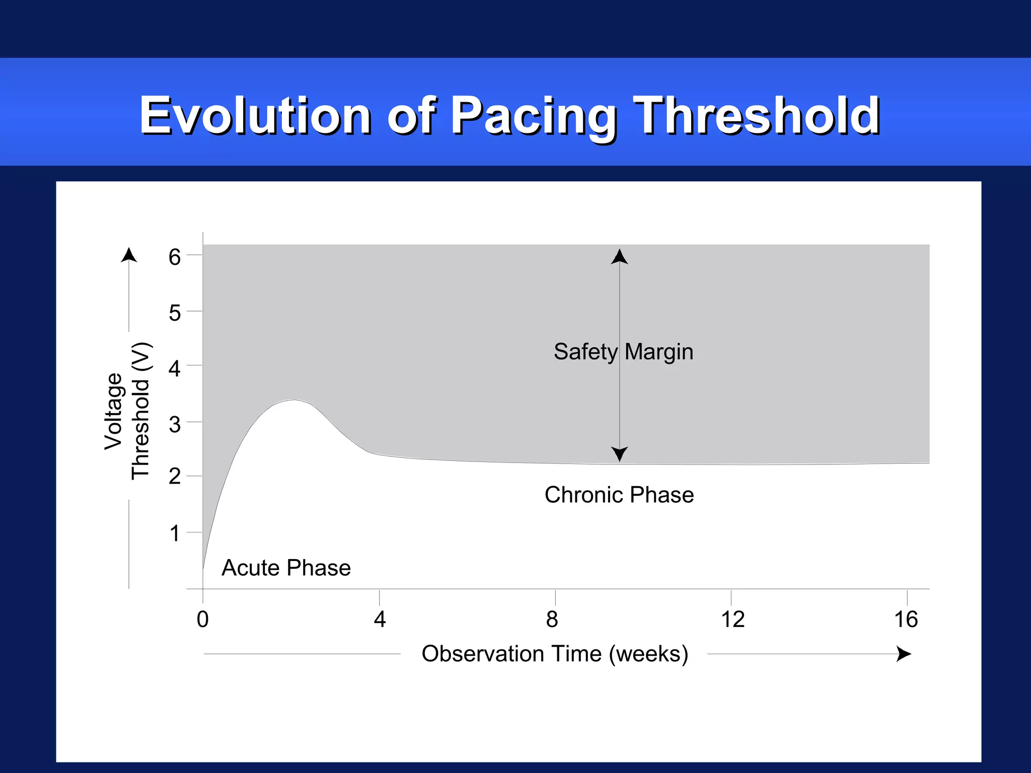Evolution of Pacing ThresholdEvolution of Pacing ThresholdVoltage
Threshold(V)
Observation Time (weeks)
Acute Phase
Chronic Phase
Safety Margin
6
5
4
3
2
1
0 4 8 12 16
 