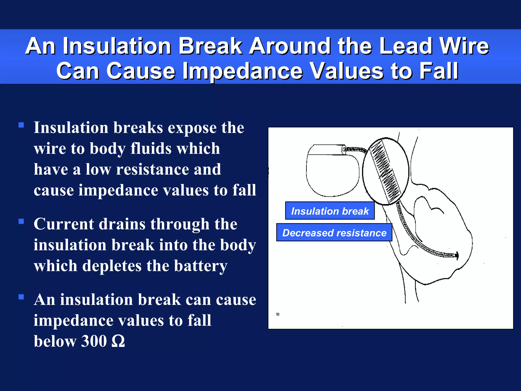 An Insulation Break Around the Lead WireAn Insulation Break Around the Lead Wire
Can Cause Impedance Values to FallCan Cause Impedance Values to Fall
 Insulation breaks expose the
wire to body fluids which
have a low resistance and
cause impedance values to fall
 Current drains through the
insulation break into the body
which depletes the battery
 An insulation break can cause
impedance values to fall
below 300 Ω
Insulation break
Decreased resistance
 