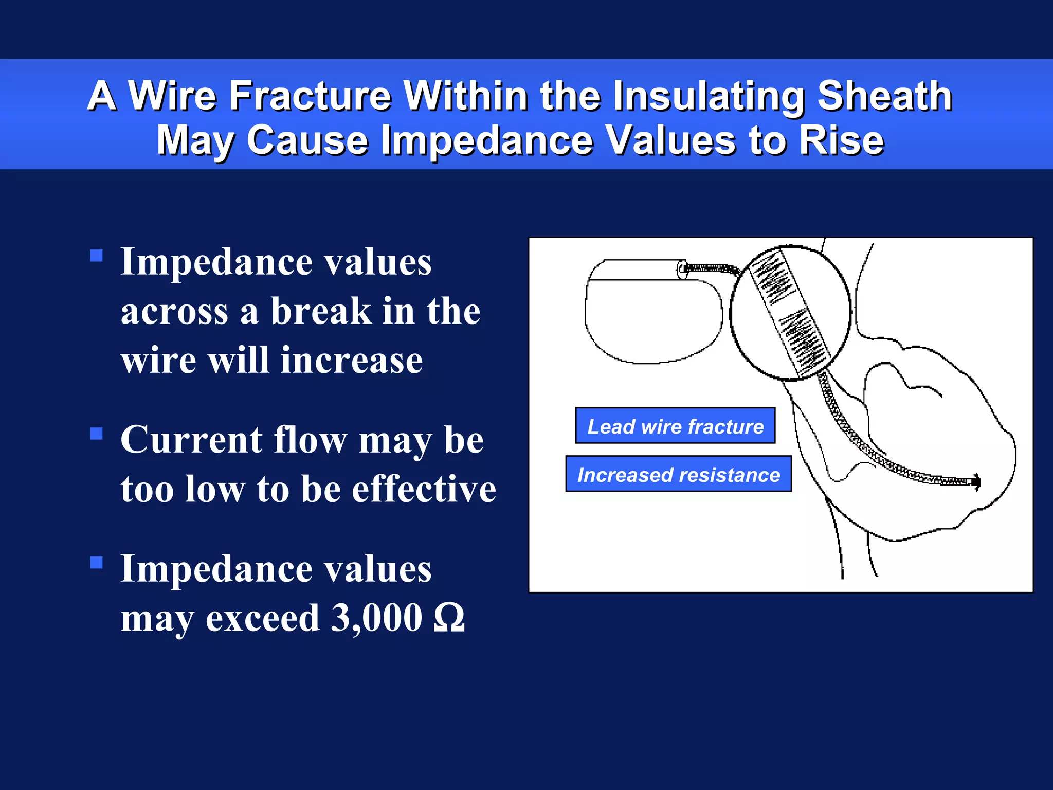 A Wire Fracture Within the Insulating SheathA Wire Fracture Within the Insulating Sheath
May Cause Impedance Values to RiseMay Cause Impedance Values to Rise
 Impedance values
across a break in the
wire will increase
 Current flow may be
too low to be effective
 Impedance values
may exceed 3,000 Ω
Lead wire fracture
Increased resistance
 