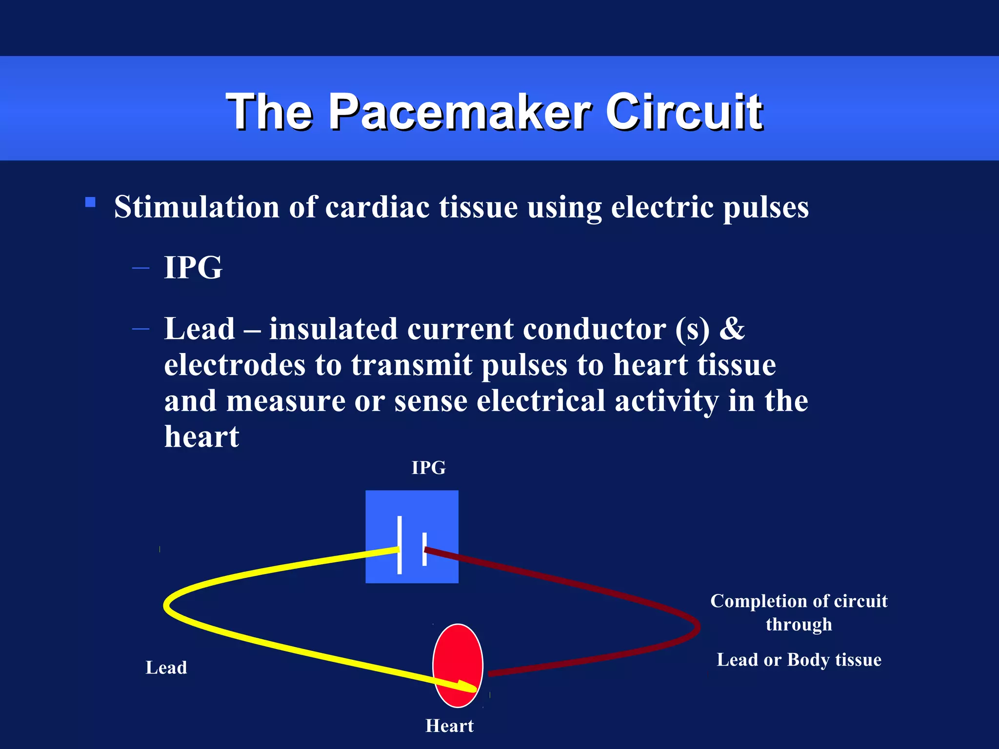 The Pacemaker CircuitThe Pacemaker Circuit
 Stimulation of cardiac tissue using electric pulses
– IPG
– Lead – insulated current conductor (s) &
electrodes to transmit pulses to heart tissue
and measure or sense electrical activity in the
heart
Heart
Lead
IPG
Completion of circuit
through
Lead or Body tissue
 