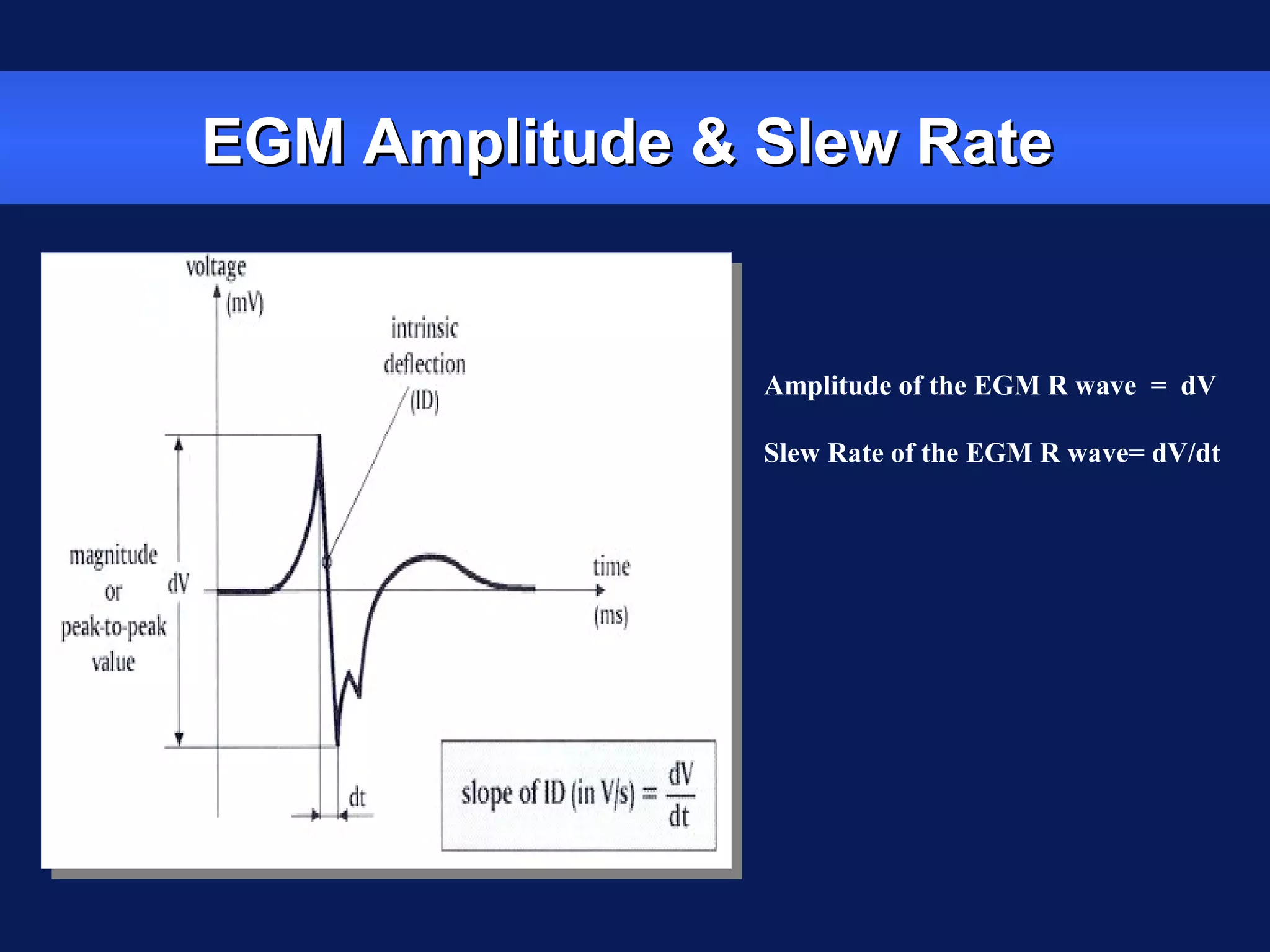 EGM Amplitude & Slew RateEGM Amplitude & Slew Rate
Amplitude of the EGM R wave = dV
Slew Rate of the EGM R wave= dV/dt
 