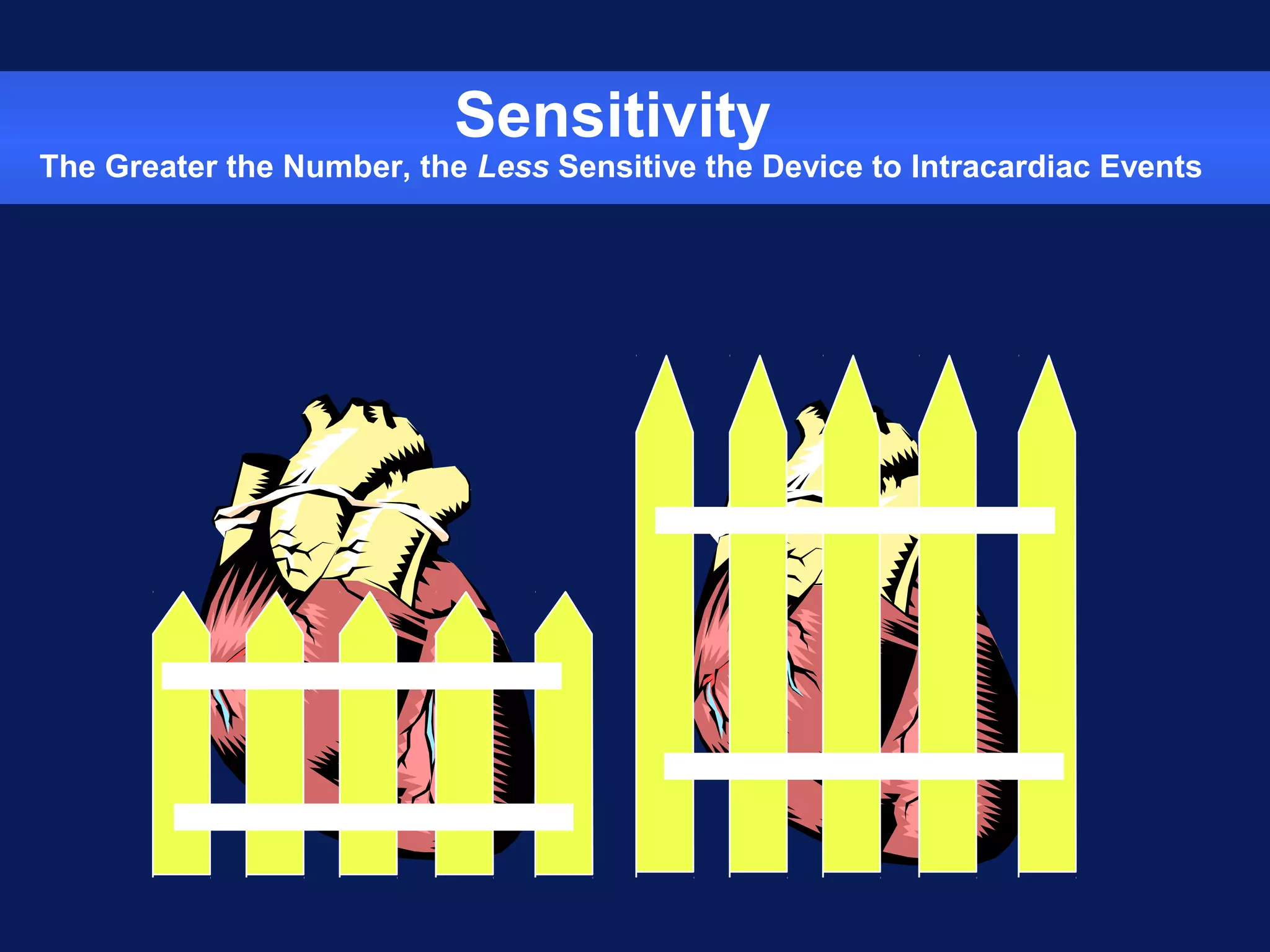 Sensitivity
The Greater the Number, the Less Sensitive the Device to Intracardiac Events
 