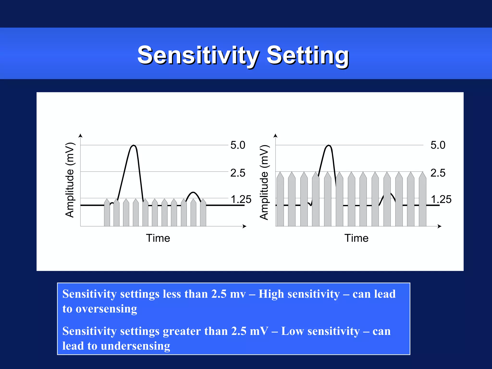 Sensitivity SettingSensitivity Setting
Sensitivity settings less than 2.5 mv – High sensitivity – can lead
to oversensing
Sensitivity settings greater than 2.5 mV – Low sensitivity – can
lead to undersensing
Amplitude(mV)
Amplitude(mV)
Time Time
5.0
2.5
1.25
5.0
2.5
1.25
 