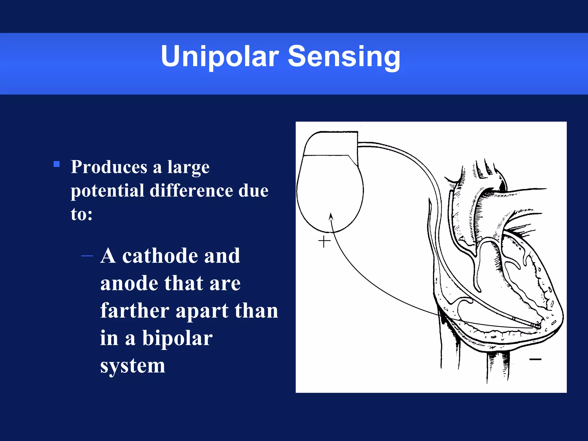 Unipolar Sensing
 Produces a large
potential difference due
to:
– A cathode and
anode that are
farther apart than
in a bipolar
system
_
 