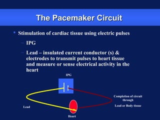 Basic technical concepts in cardiac pacing | PPT