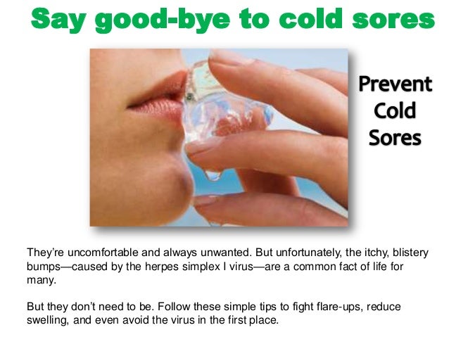 Basic Tips Of How To Prevent Cold Sores