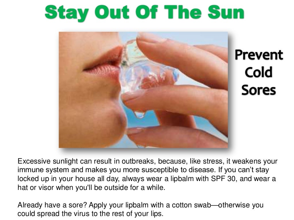 Basic tips of How to prevent cold sores