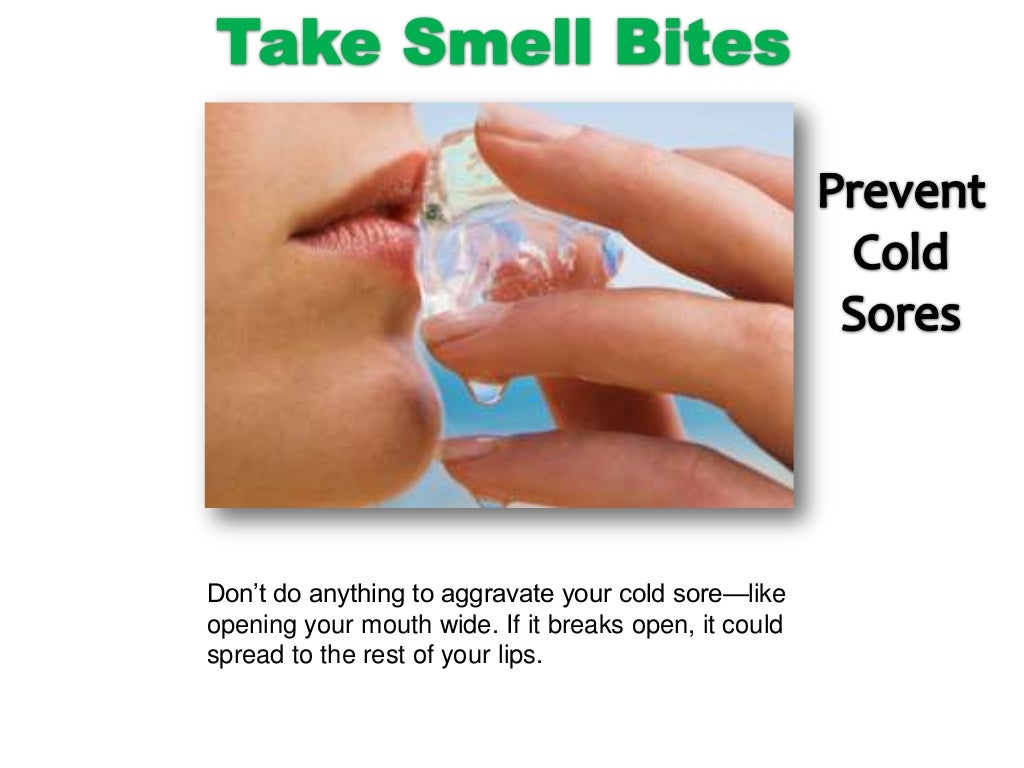 Basic tips of How to prevent cold sores