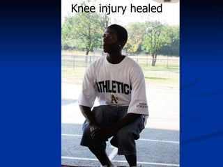 Knee injury healed 