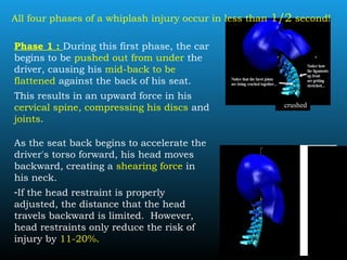 crushed
All four phases of a whiplash injury occur in less than 1/2 second!
Phase 1 : During this first phase, the car
begins to be pushed out from under the
driver, causing his mid-back to be
flattened against the back of his seat.
This results in an upward force in his
cervical spine, compressing his discs and
joints.
As the seat back begins to accelerate the
driver's torso forward, his head moves
backward, creating a shearing force in
his neck.
-If the head restraint is properly
adjusted, the distance that the head
travels backward is limited. However,
head restraints only reduce the risk of
injury by 11-20%.
 