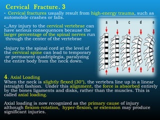 3.Cervical Fracture
- Cervical fractures usually result from high-energy trauma, such as
automobile crashes or falls.
- Any injury to the cervical vertebrae can
have serious consequences because the
larger percentage of the spinal nerves run
through the center of the vertebrae
-Injury to the spinal cord at the level of
the cervical spine can lead to temporary
or permanent quadriplegia, paralyzing
the entire body from the neck down.
4. Axial Loading
When the neck is slightly flexed (30°), the vertebra line up in a linear
(straight) fashion. Under this alignment, the force is absorbed entirely
by the bones ligaments and disks, rather than the muscles. This is
called axial loading.
Axial loading is now recognized as the primary cause of injury
although flexion-rotation, hyper-flexion, or extension may produce
significant injuries.
 