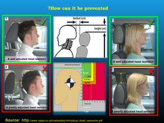 Source: http://www.rospa.co.uk/roadsafety/info/adjust_head_restraints.pdf
How can it be prevented?
 