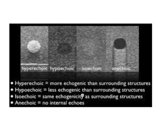 BASIC ULTRASOUND.pdf