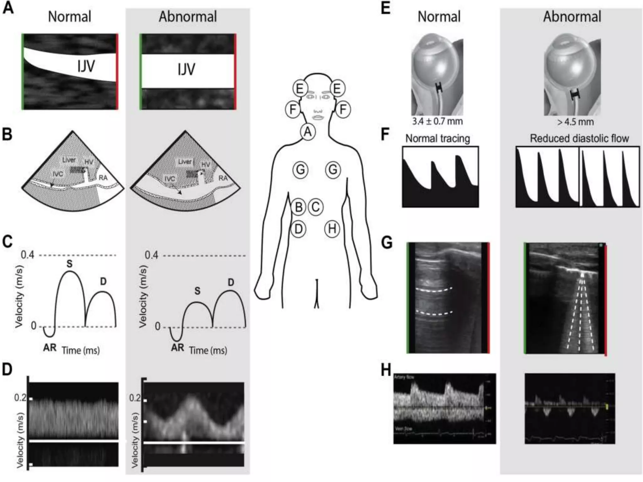 Basic ultrasound in icu | PPTX