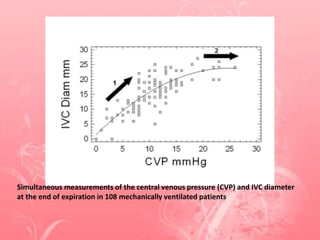 Simultaneous measurements of the central venous pressure (CVP) and IVC diameter
at the end of expiration in 108 mechanically ventilated patients
 