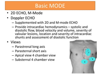 Basic MODE
• 2D ECHO, M-Mode
• Doppler ECHO
– Supplemented with 2D and M-mode ECHO
– Provide intracardiac hemodynamics – systolic and
diastolic flow, blood velocity and volume, severity of
valvular lesions, location and severity of intracardiac
shunts and assessment of diastolic function
• Views
– Parastrenal long axis
– Parasternal short axis
– Apical view 4 chamber view
– Substernal 4 chamber view
 