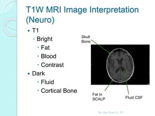 T1W MRI Image Interpretation
(Neuro)
 T1
◦ Bright
 Fat
 Blood
 Contrast
 Dark
 Fluid
 Cortical Bone
Skull
Bone
Fat in
SCALP Fluid CSF
By: Gan Quan Fu, PT
 