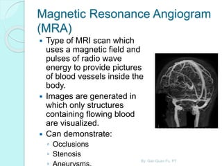 Magnetic Resonance Angiogram
(MRA)
 Type of MRI scan which
uses a magnetic field and
pulses of radio wave
energy to provide pictures
of blood vessels inside the
body.
 Images are generated in
which only structures
containing flowing blood
are visualized.
 Can demonstrate:
◦ Occlusions
◦ Stenosis
By: Gan Quan Fu, PT
 