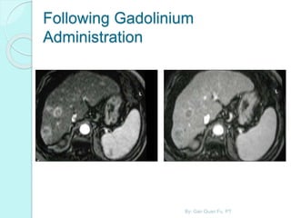 Following Gadolinium
Administration
By: Gan Quan Fu, PT
 