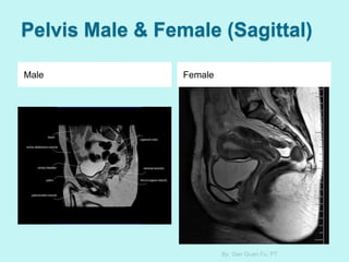 Pelvis Male & Female (Sagittal)
Male Female
By: Gan Quan Fu, PT
 
