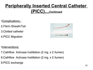Complications : Fibrin Sheath/Tail Clotted catheter  PICC Migration Interventions: Cathflow  Activase Instillation (2 mg. x 2 /lumen)  Cathflow  Activase Instillation (2 mg. x 2 /lumen) PICC exchange Exchange Repairs of Groshongs are no longer done  Peripherally Inserted Central Catheter  (PICC)… Continued 