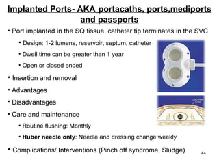 Implanted Ports- AKA   portacaths, ports,mediports and passports Port implanted in the SQ tissue, catheter tip terminates in the SVC Design: 1-2 lumens, reservoir, septum, catheter Dwell time can be greater than 1 year Open or closed ended Insertion and removal Advantages Disadvantages Care and maintenance Routine flushing: Monthly Huber needle only : Needle and dressing change weekly Complications/ Interventions (Pinch off syndrome, Sludge) 
