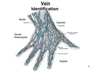 Vein Identification Basilic Cephalic Digitals Dorsal Metacarpals 