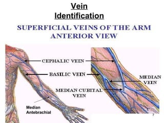 Basilic Vein Vein Identification Median Antebrachial 