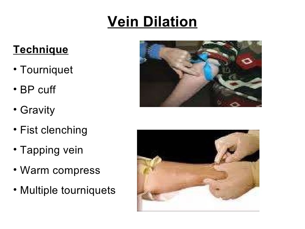 Basic Vascular Access Ice Ppt Presentation.Ppt2