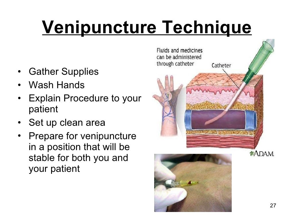 Basic Vascular Access Ice Ppt Presentation.Ppt2