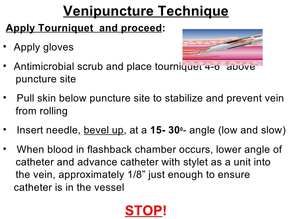 Basic Vascular Access Ice Ppt Presentation.Ppt2