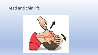 Head and chin lift:
 