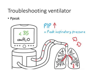 Basic Ventilator Setting NIV.pptx