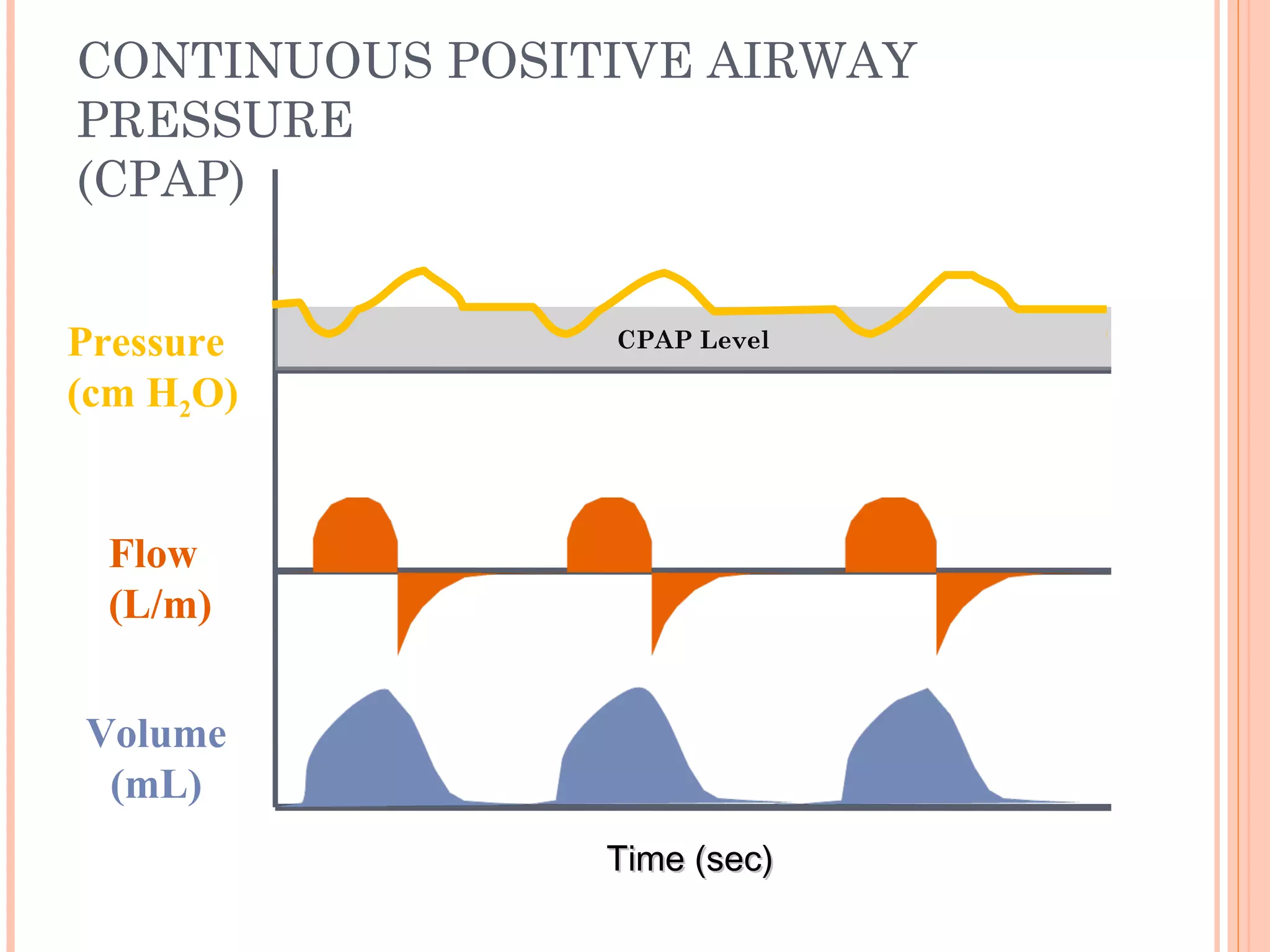 CONTINUOUS POSITIVE AIRWAY
PRESSURE
(CPAP)
Time (sec)Time (sec)
Flow
(L/m)
Pressure
(cm H2O)
Volume
(mL)
CPAP Level
 