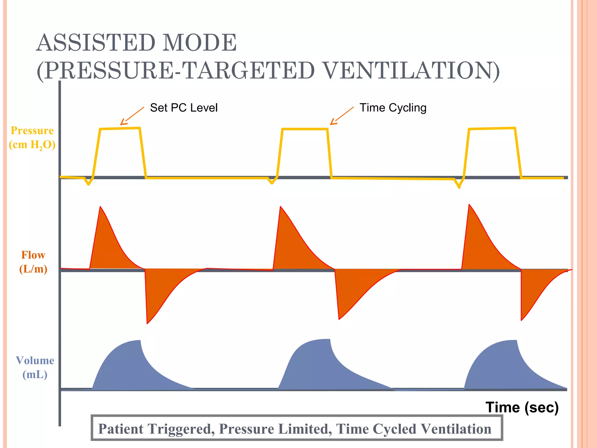 ASSISTED MODE
(PRESSURE-TARGETED VENTILATION)
Flow
(L/m)
Pressure
(cm H2O)
Volume
(mL)
Patient Triggered, Pressure Limited, Time Cycled Ventilation
Time (sec)
Time CyclingSet PC Level
 