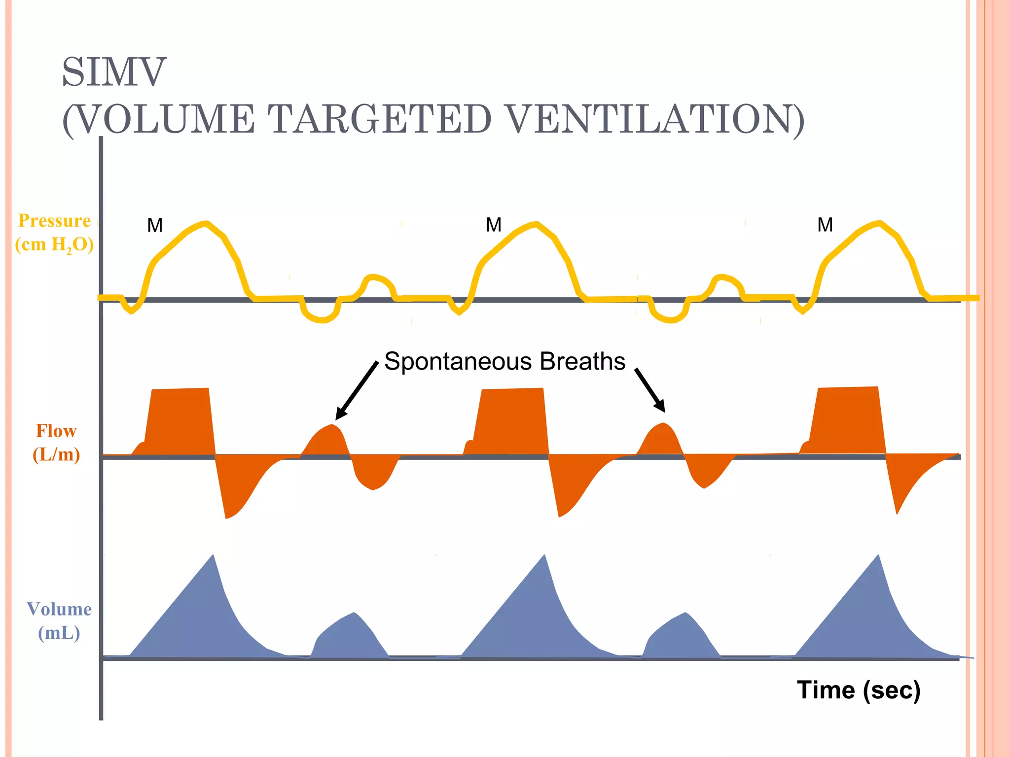SIMV
(VOLUME TARGETED VENTILATION)
Flow
(L/m)
Pressure
(cm H2O)
Volume
(mL)
Spontaneous Breaths
M M M
Time (sec)
 