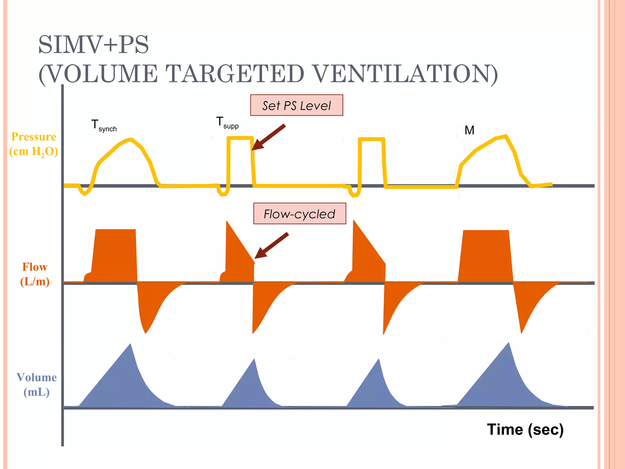 SIMV+PS
(VOLUME TARGETED VENTILATION)
Flow
(L/m)
Pressure
(cm H2O)
Volume
(mL)
M
TsuppTsynch
Set PS Level
Flow-cycled
Time (sec)
 