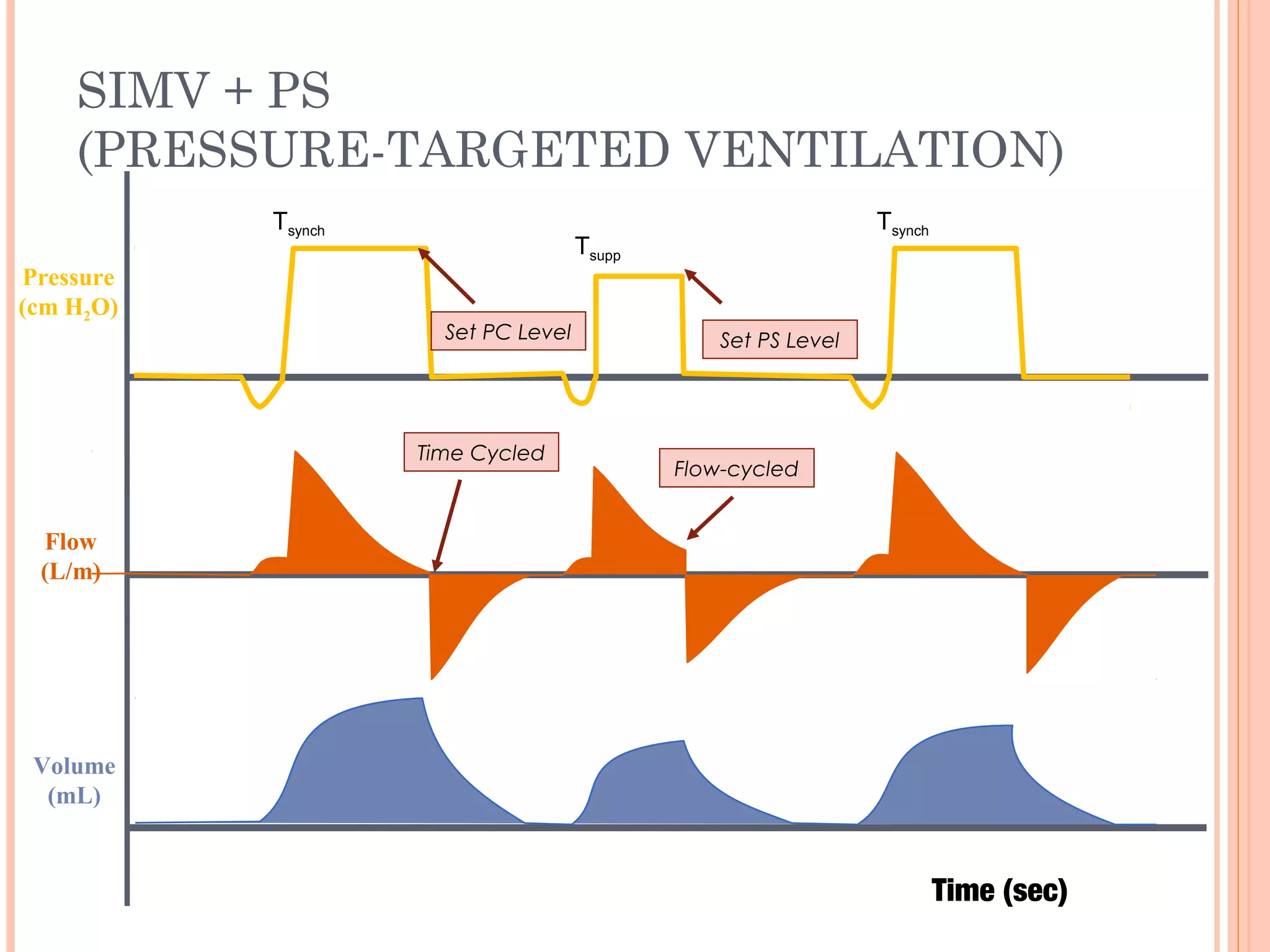 SIMV + PS
(PRESSURE-TARGETED VENTILATION)
Flow
(L/m)
Pressure
(cm H2O)
Volume
(mL)
Tsupp
Tsynch
Time Cycled
Flow-cycled
Tsynch
Set PC Level Set PS Level
Time (sec)
 