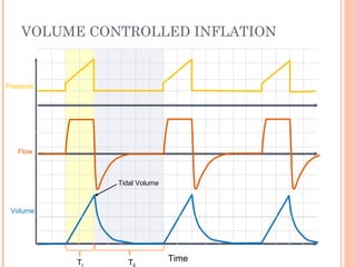 VOLUME CONTROLLED INFLATION
Time
Flow
Pressure
Volume
T T
Tidal Volume
 