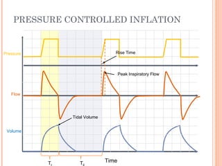 PRESSURE CONTROLLED INFLATION
Time
Flow
Pressure
Volume
T T
Tidal Volume
Rise Time
Peak Inspiratory Flow
 