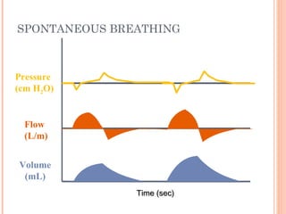 SPONTANEOUS BREATHING
Time (sec)Time (sec)
Flow
(L/m)
Pressure
(cm H2O)
Volume
(mL)
 